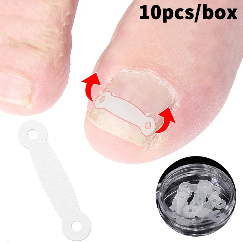 10PCS Ingrown Toe Nail Treatment Ingrown Toenail Correction Tool Elastic Patch Sticker Straightening Clip Brace Pedicure Tools