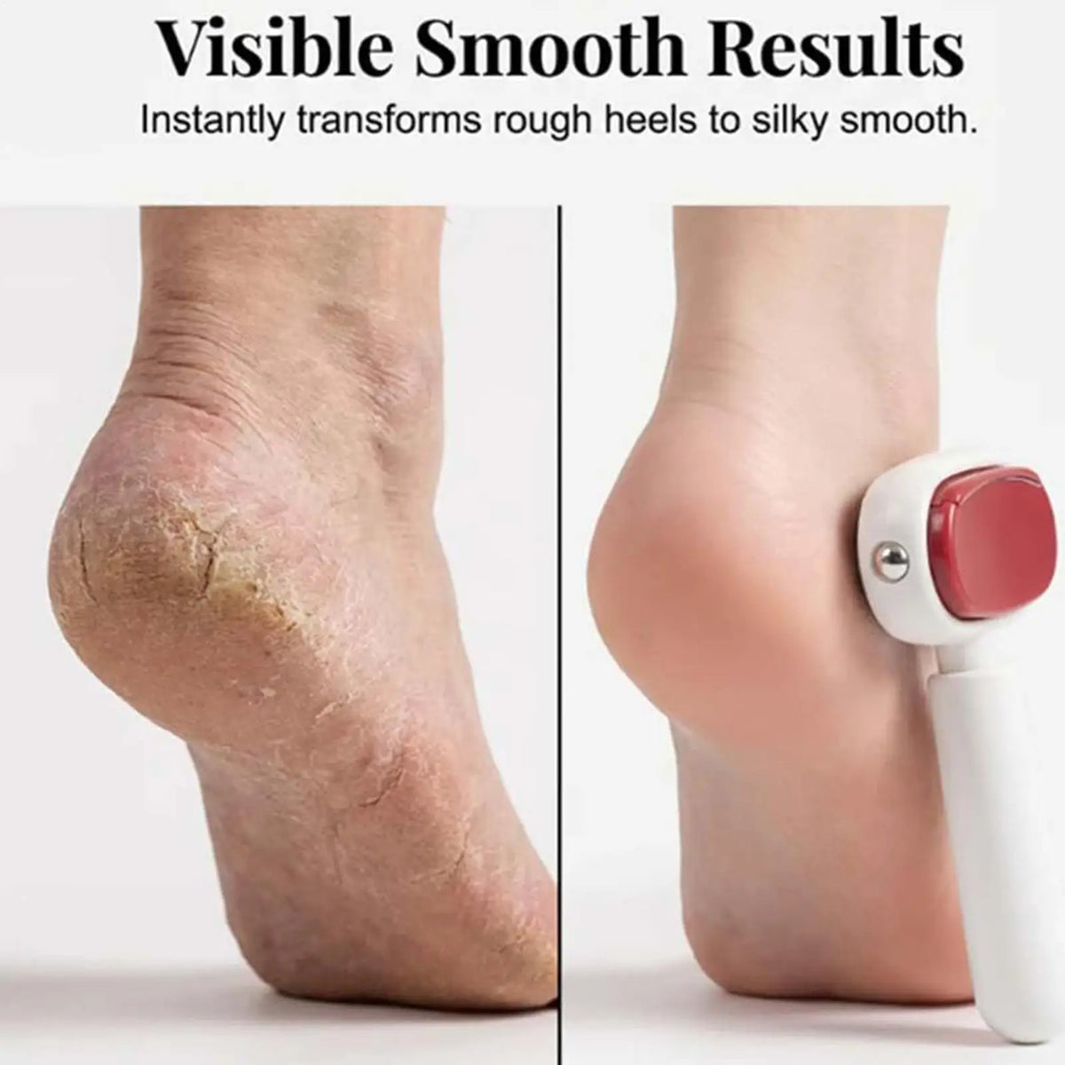 Double Side Foot Rasp Hard Dead Skin File Calluses Remover Foot Care Pedicure Grinding Tools Stainless Steel Beauty Tools